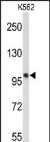 Rabbit Polyclonal Antibody to HSPH1