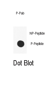 Rabbit Polyclonal Antibody to Phospho-SMAD2(T220)
