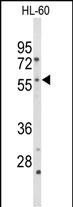 Rabbit Polyclonal Antibody to CYP2C19 (N-term)