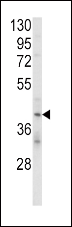 Rabbit Polyclonal Antibody to KIR2DL4