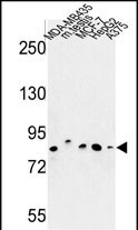 Rabbit Polyclonal Antibody to CHPF