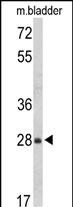 Rabbit Polyclonal Antibody to RABAC1 (N-term)