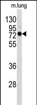 Rabbit Polyclonal Antibody to EEFSEC