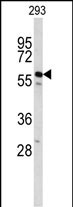 Rabbit Polyclonal Antibody to CDC14B