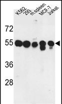 Rabbit Polyclonal Antibody to PPM1H