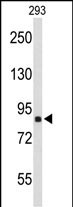 Rabbit Polyclonal Antibody to TNPO1 (N-term)