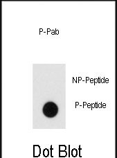 Rabbit Polyclonal Antibody to Phospho-Endophilin(Y80)
