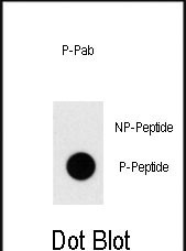 Rabbit Polyclonal Antibody to Phospho-TAL1(T90)