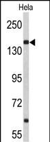 Rabbit Polyclonal Antibody to NUP153 (N-term)