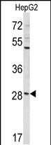 Rabbit Polyclonal Antibody to DIPA