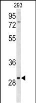 Rabbit Polyclonal Antibody to CLRN3