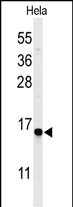 Rabbit Polyclonal Antibody to GABARAPL1