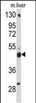 Rabbit Polyclonal Antibody to ACBD5 (N-term)
