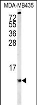 Rabbit Polyclonal Antibody to COX6A1