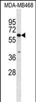 Rabbit Polyclonal Antibody to CES7