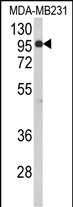 Rabbit Polyclonal Antibody to BAHD1