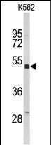 Rabbit Polyclonal Antibody to KIR3DL3