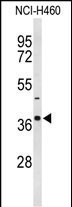 Rabbit Polyclonal Antibody to SLC25A17 (N-term)