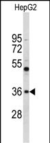 Rabbit Polyclonal Antibody to ELOVL2 (N-term)