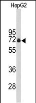 Rabbit Polyclonal Antibody to FBXO3