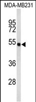 Rabbit Polyclonal Antibody to FLAD1