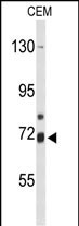 Rabbit Polyclonal Antibody to ALOX15B