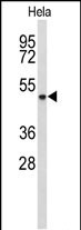 Rabbit Polyclonal Antibody to ADH6