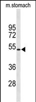 Rabbit Polyclonal Antibody to KCNJ11 (N-term)