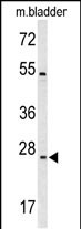 Rabbit Polyclonal Antibody to TSPAN6