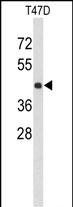 Rabbit Polyclonal Antibody to KCTD12