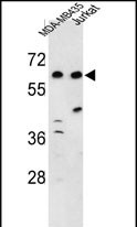 Rabbit Polyclonal Antibody to C19orf26