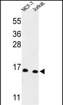 Rabbit Polyclonal Antibody to SNRPD3