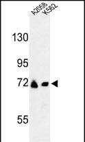 Rabbit Polyclonal Antibody to GFPT2