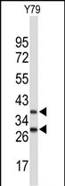 Rabbit Polyclonal Antibody to FBXO4