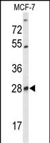 Rabbit Polyclonal Antibody to SELT (N-term)