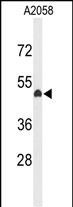 Rabbit Polyclonal Antibody to EYA4
