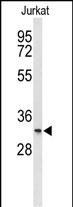 Rabbit Polyclonal Antibody to T150A