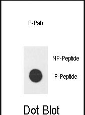 Rabbit Polyclonal Antibody to Phospho-E2F1(H357)