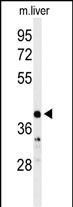 Rabbit Polyclonal Antibody to CA5B