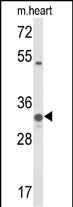 Rabbit Polyclonal Antibody to COQ5
