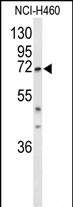 Rabbit Polyclonal Antibody to DDX17 (N-term)