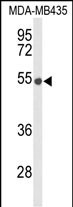 Rabbit Polyclonal Antibody to DMC1 (N-term)
