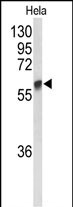 Rabbit Polyclonal Antibody to GALNT2 (N-term)