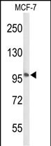 Rabbit Polyclonal Antibody to ADCY7