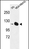 Rabbit Polyclonal Antibody to DIAPH2