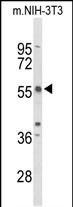 Rabbit Polyclonal Antibody to TAC2N (N-term)