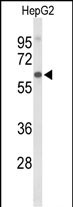 Rabbit Polyclonal Antibody to AFM (N-term)