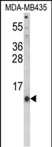 Rabbit Polyclonal Antibody to HAMP