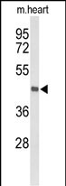 Rabbit Polyclonal Antibody to DBC1 (N-term)