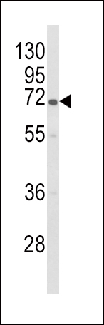 Rabbit Polyclonal Antibody to GBE1